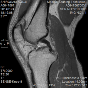MRI